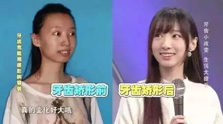 39元抢购原价600元禹州雅莱美口腔套餐! 39元抢购原价600元禹州雅莱美口腔套餐!