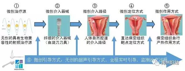 禹州市妇幼保健院引进新仪器“BBT”自凝刀微创治疗术! 禹州市妇幼保健院引进新仪器“BBT”自凝刀微创治疗术!