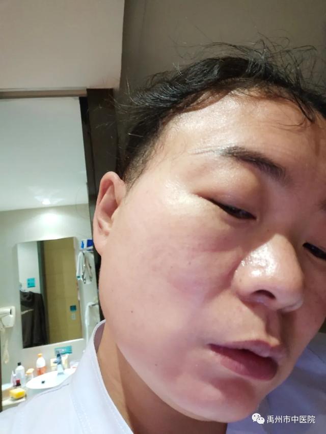 禹州市中医院孟媛媛、苗培娟首次上岗"方舱医院"! 禹州市中医院孟媛媛、苗培娟首次上岗"方舱医院"!