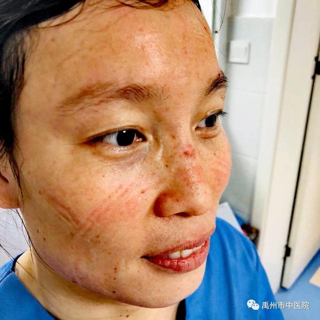 禹州市中医院:“战役”的每个瞬间,都令人刻骨铭心! 禹州市中医院:“战役”的每个瞬间,都令人刻骨铭心!