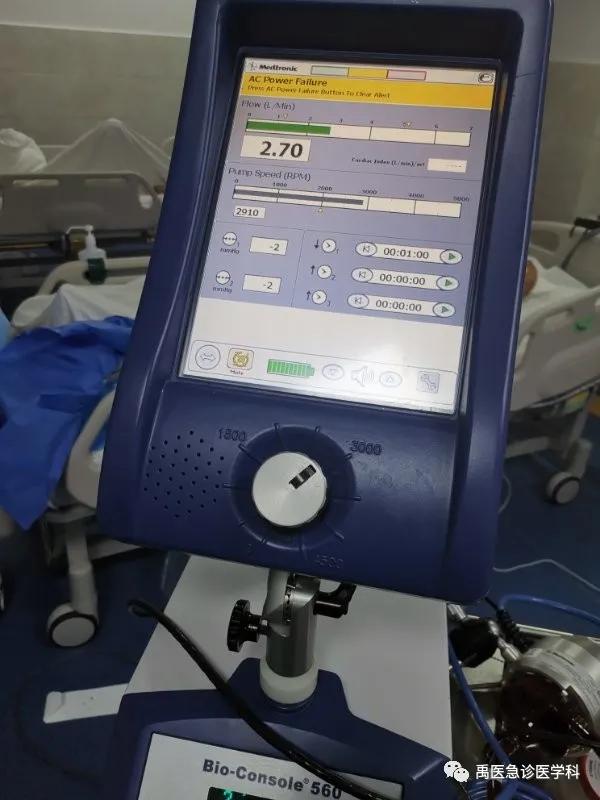 禹州市人民医院急诊科ECMO成为击退死神的医疗“硬科技” 禹州市人民医院急诊科ECMO成为击退死神的医疗“硬科技”