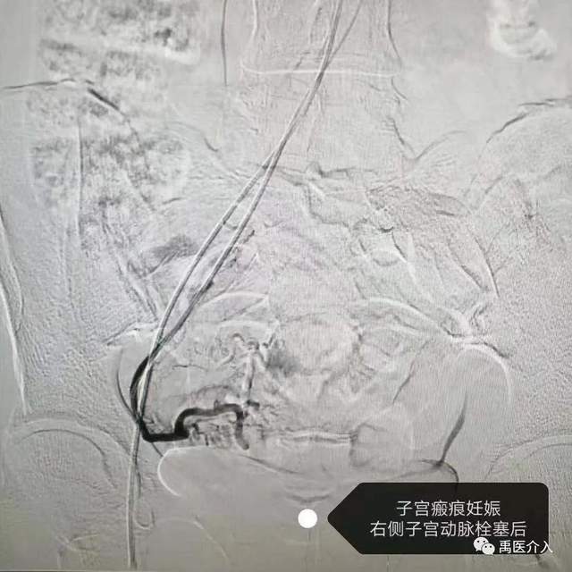 祝贺禹州市人民医院成为“中国县域医院出血中心联盟理事单位” 祝贺禹州市人民医院成为“中国县域医院出血中心联盟理事单位”