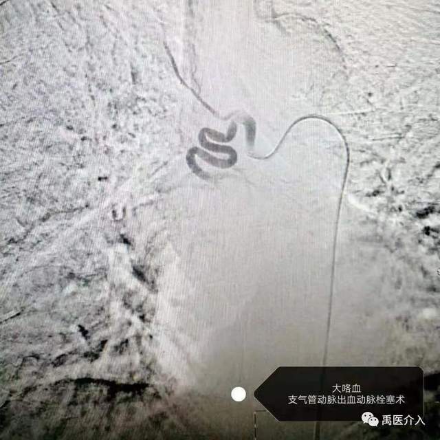 祝贺禹州市人民医院成为“中国县域医院出血中心联盟理事单位” 祝贺禹州市人民医院成为“中国县域医院出血中心联盟理事单位”