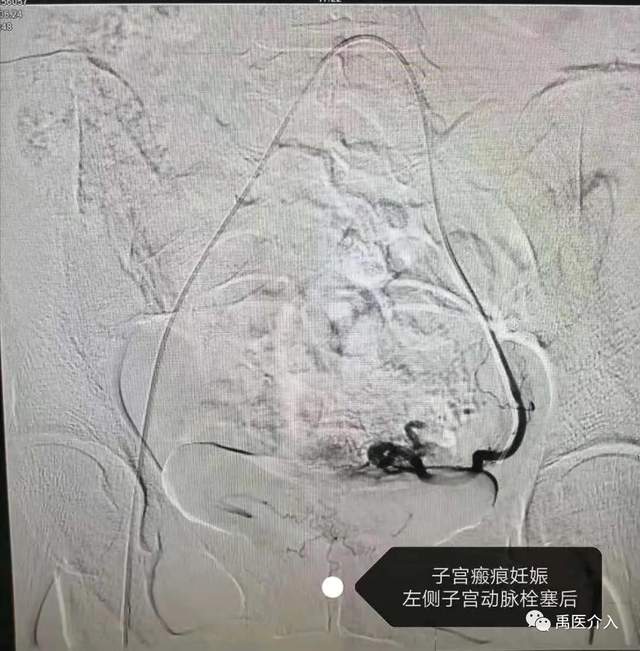 祝贺禹州市人民医院成为“中国县域医院出血中心联盟理事单位” 祝贺禹州市人民医院成为“中国县域医院出血中心联盟理事单位”
