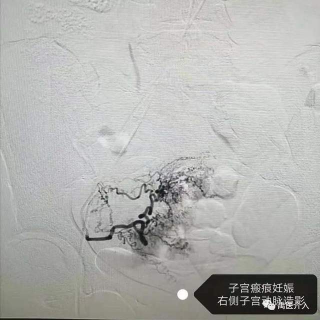 祝贺禹州市人民医院成为“中国县域医院出血中心联盟理事单位” 祝贺禹州市人民医院成为“中国县域医院出血中心联盟理事单位”