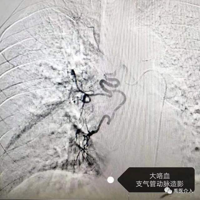 祝贺禹州市人民医院成为“中国县域医院出血中心联盟理事单位” 祝贺禹州市人民医院成为“中国县域医院出血中心联盟理事单位”