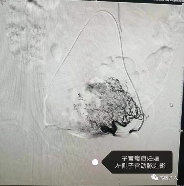 祝贺禹州市人民医院成为“中国县域医院出血中心联盟理事单位” 祝贺禹州市人民医院成为“中国县域医院出血中心联盟理事单位”