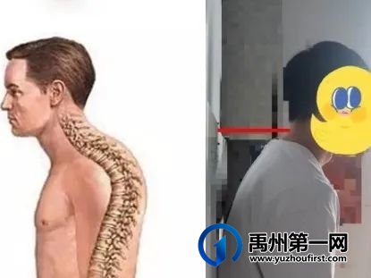 禹州市人民医院儿童康复暑期形体矫治训练班开始啦! 禹州市人民医院儿童康复暑期形体矫治训练班开始啦!