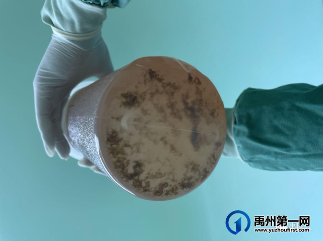 禹州市人民医院呼吸与危重症医学科成功开展全肺灌洗术! 禹州市人民医院呼吸与危重症医学科成功开展全肺灌洗术!
