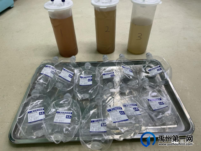禹州市人民医院呼吸与危重症医学科成功开展全肺灌洗术! 禹州市人民医院呼吸与危重症医学科成功开展全肺灌洗术!